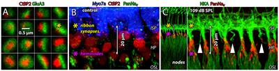 Reducing Auditory Nerve Excitability by Acute Antagonism of Ca2+-Permeable AMPA Receptors